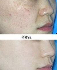 福州美容院最新爆料,美容行业最新潮流与秘密大曝光  第1张